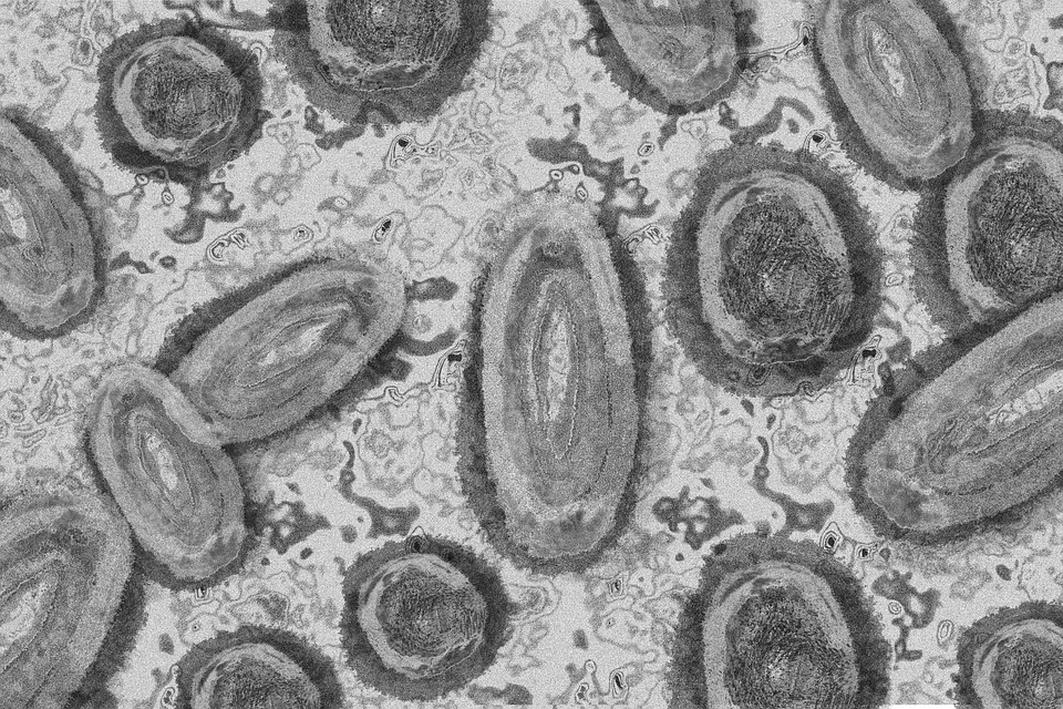 9 Cara Menyembuhkan Cacar Air Dengan Bahan Alami