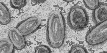 9 Cara Mengobati Cacar Air